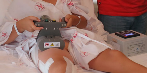 Çocuklarda Bacak Kısalıklarına Kumandalı Tedavi